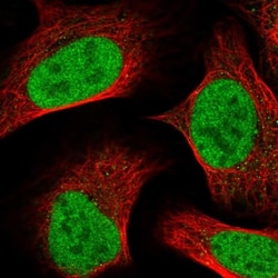 TM2D1 Antibody, Novus Biologicals 25 &mu;L, Unlabeled:Antibodies, Polyclonal